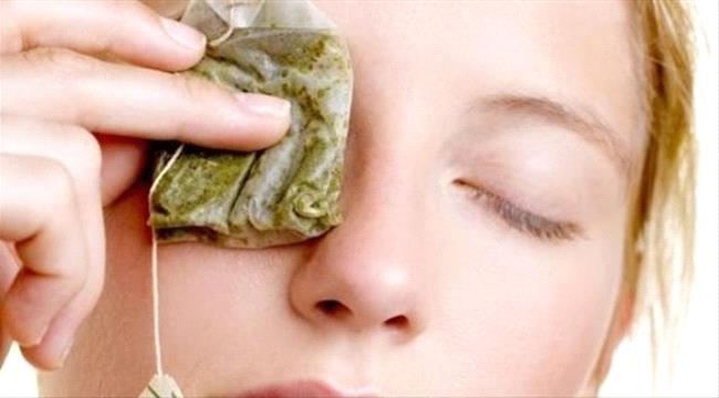 أكياس الشاي لا تنفع لعلاج التهاب العين