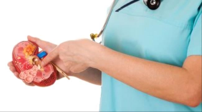 علاج حصى الحالب بالصدمة والمنظار