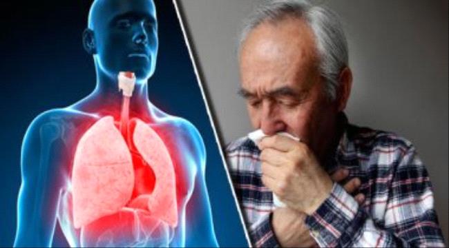 صحتك فى وصفة..الجينسينج وزيت النعناع لعلاج التهاب الشعب الهوائية
