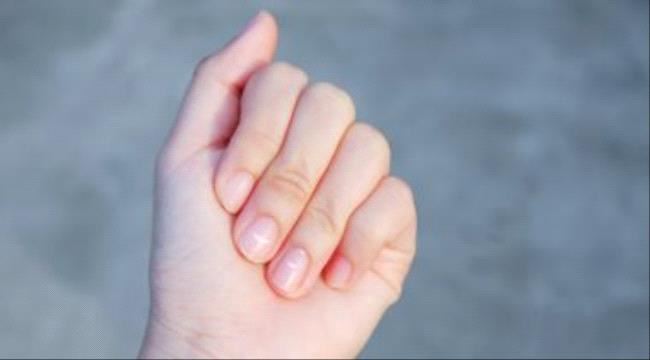5 نصائح للوقاية من بقع الأظافر البيضاء.. تغذية جيدة وشرب الماء