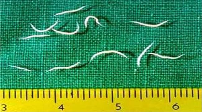 دكتور عدني يكتب:الديدان الاكثر إصابة للاطفال في مجتمعنا