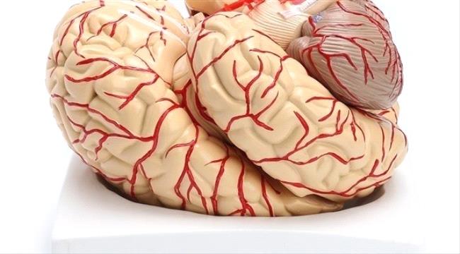 ابتكار روبوت على شكل خيط للمرور عبر شرايين المخ