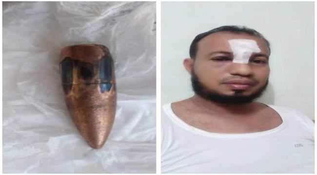 الفضلي ينجو من رصاصة راجعة كادت تودي بحياته ب#أبيـن