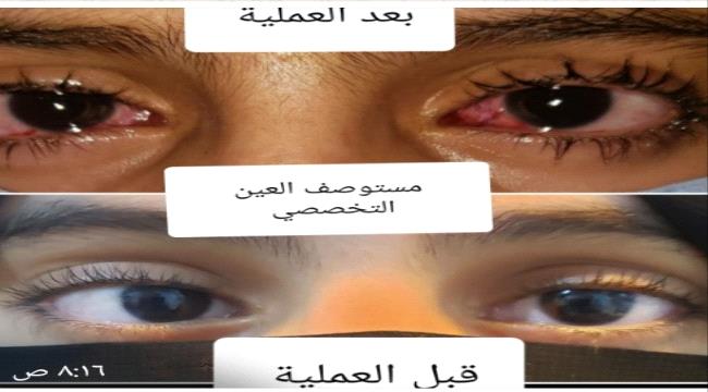 ‪ مستوصف العين التخصصي بعدن ينجح في تصحيح حول عيني فتاة ‬