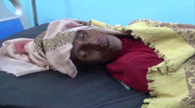 إستشهاد امرأة برصاص قناص مليشيات الحوثي في منطقة الشعينة جنوب حيس 