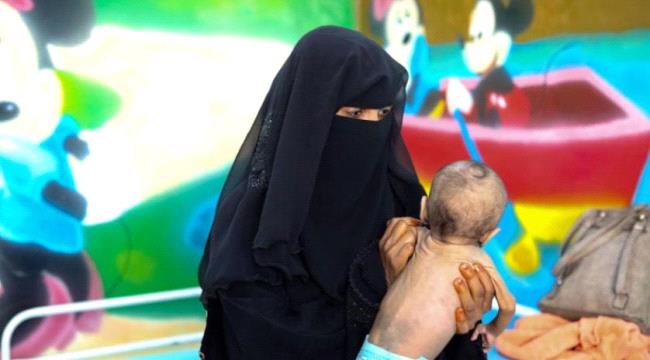 الشرق الاوسط : تهاوي قطاع الصحة في اليمن يرفع معدلات سوء تغذية الأطفال