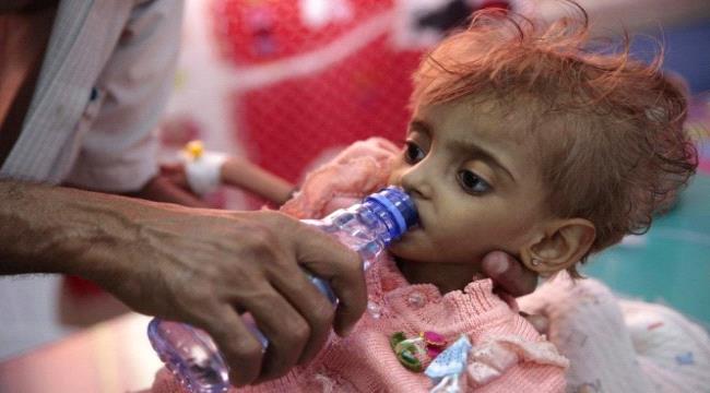 الدفتيريا تتصدر قائمة الأوبئة الأكثر حصدا لأرواح اليمنيين