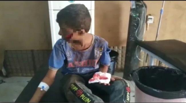 صحفي: المنشغلون بالعنف ضد المرأة لم يتحدثوا عن قتل الحوثي أطفال ونساء في الحديدة