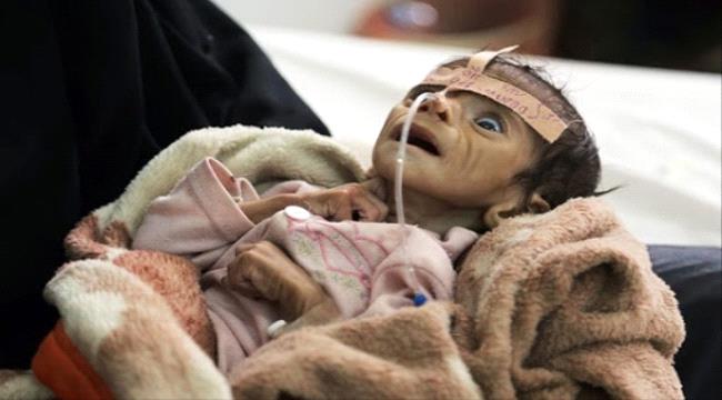 الأغذية العالمي: أكثر من 24 مليون يمني بحاجة ماسة إلى المساعدات الإنسانية