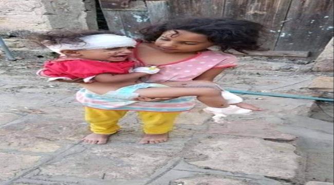 صحفي: جرائم بشعة يندى لها الجبين في تعز