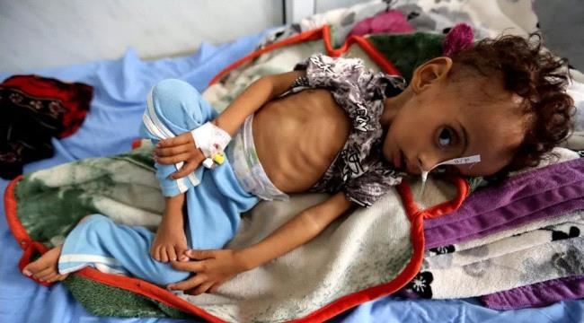 منظمة دولية: أطفال اليمن يدفعون الثمن النهائي للحرب
