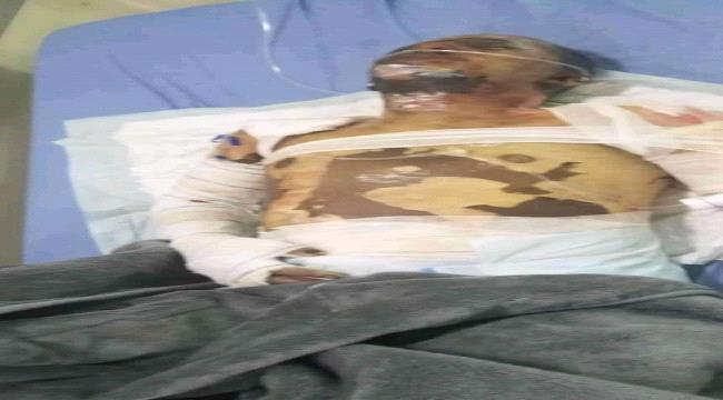 إب... مواطن يقدم على إحراق نفسه بعد فشله في الحصول على  اسطوانة غاز