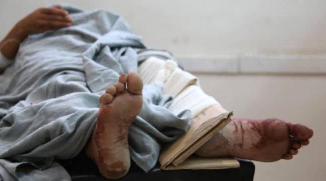 مقتل امرأة وطفلة في قصف حوثي بتعز