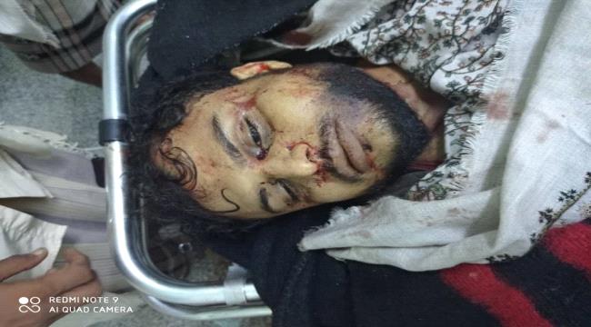 مقتل نجل الشهيد علي صالح الحدي وعلاء الحميقاني في زنجبار