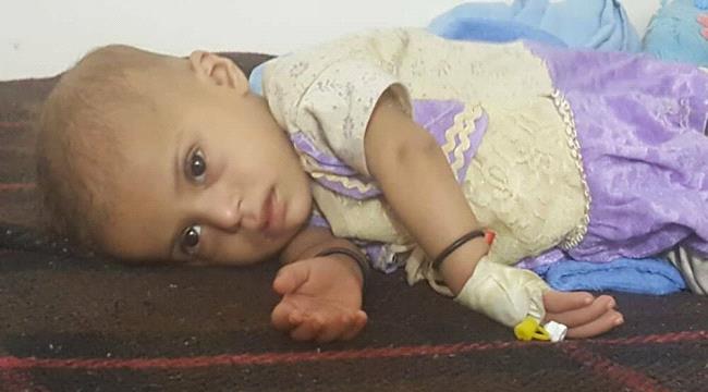 "يونيسف": مليونا طفل باليمن يكافحون من أجل البقاء على قيد الحياة