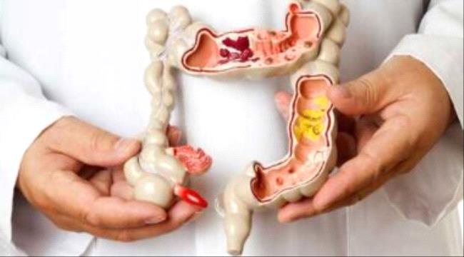 7 أطعمة لتنظيف القولون أبرزها الزنجبيل وعصير الخضار والفاكهة