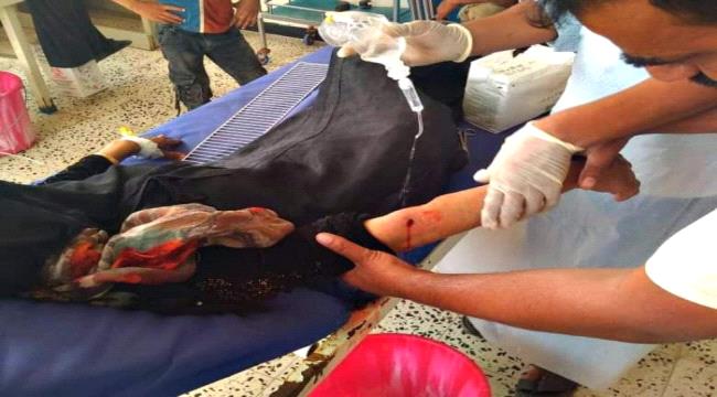 إصابة امرأتين برصاص قناص حوثي بالضالع