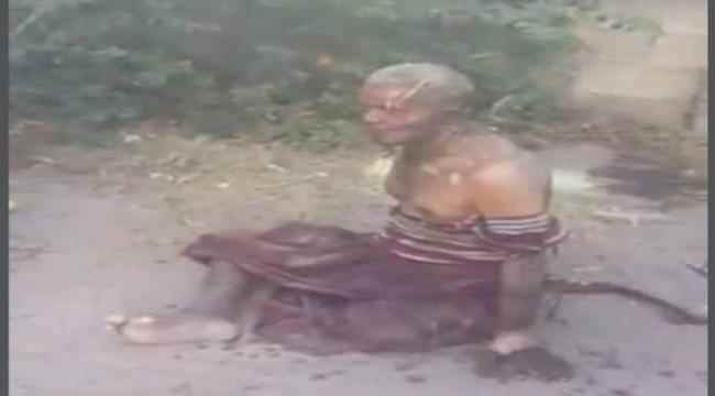 شاهد بالصورة .. مُسن يحاول الانتحار حرقًا بإب