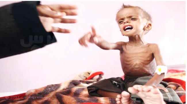 مسؤول أممي يحذر من وفاة طفل بكل دقيقة في اليمن