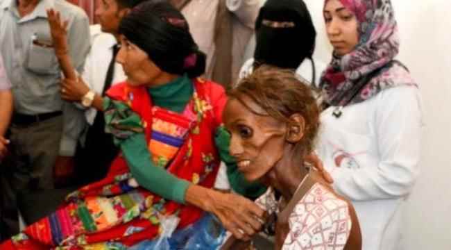 مؤتمر أممي يستهدف جمع أكثر من ٣ مليار لتغطية احتياجات المتضررين من الحرب في اليمن