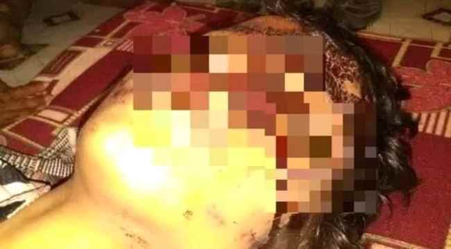 طفلة منعت حوثياً من اغتصابها.. فهشّم رأسها حتى الموت!