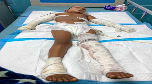 النوبة : تم اعتماد رواتب شهرية لشهداء المطار وللجرحى ذو الاصابات البليغة