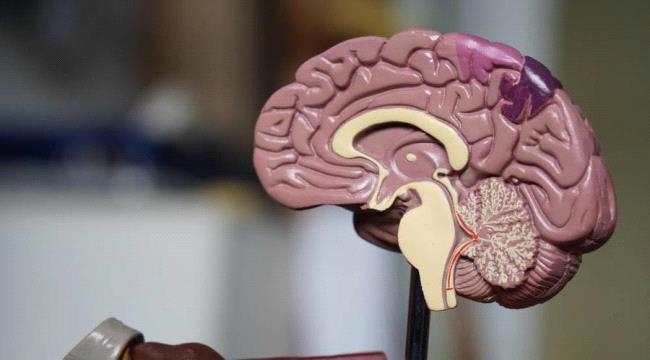 عقار جديد للزهايمر يثبت فعاليته في إبطاء المرض