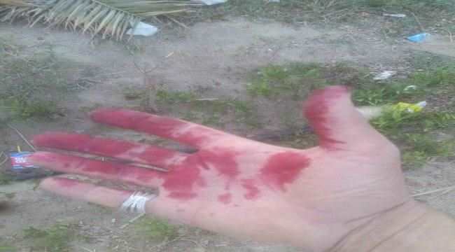 أبشع جريمة شهدها التاريخ الإنساني حصلت في اليمن..تعرف عليها