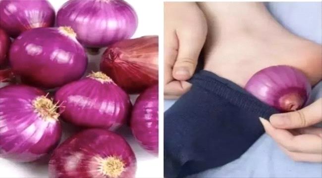 ما هي فوائد وضع شرائح البصل في جواربنا ليلاً