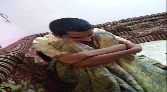 الأسير المحرر ( محمد) غيّر التعذيب في سجون الحوثيين ملامحه وأفقده الذاكرة