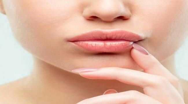 تخلّصي من تشققات الشفايف في الشتاء 
