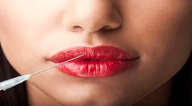 شفاه طبيعية أم فيلرز؟ هكذا تعرفين الحقيقة