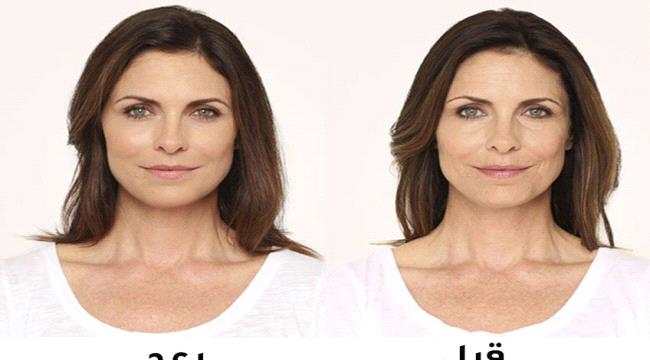 بوتوكس طبيعي لشدّ البشرة بمفعول سحري