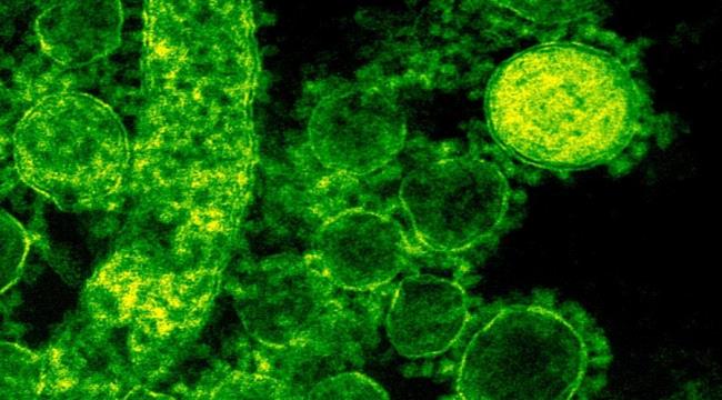 يعيش 70 عاماً داخل جهاز الرئة الحديدية بعدما أصيب بالشلل