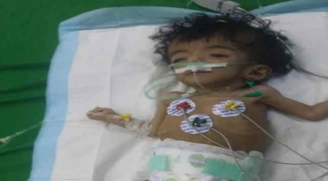 مناشدة عاجلة لانقاذ حياة الطفلة أمُنيات حاتم العُمري