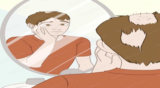 علاج الثعلبة عند الأطفال