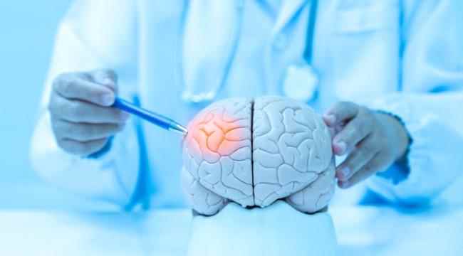 السكتة الدماغية».. أسبابها وطرق الوقاية منها