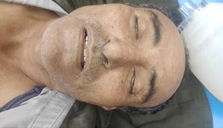 شقيق قيادي عسكري بتعز يقتل مواطن اعزل

