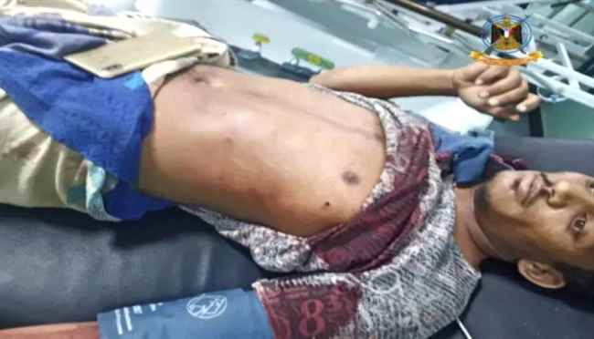 استشهاد رضيع وإصابة والده بقذيفة حوثية شمال الضالع 