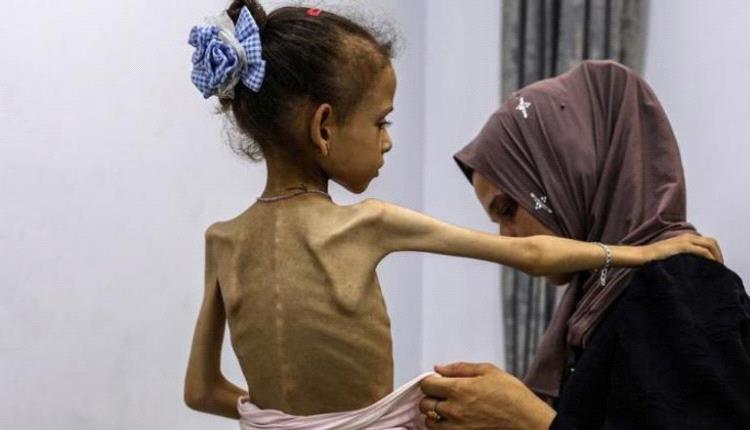 لأول مرة بالشرق الأوسط.. الأمم المتحدة تعلن رسميا المجاعة في غزة