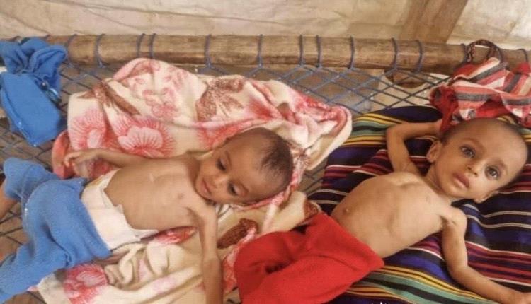 ظهور بؤرة للمجاعة في مناطق سيطرة الانقلابيين