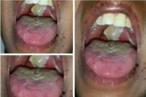 عقب تفشي مرض الدفتـ.ـيريا .. دعوات عاجلة لتفادي كارثة وبائية في هذه المحافظة!