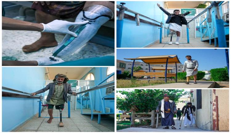 بمرحلته الحادية عشرة ..  مركز الأطراف الصناعية بمأرب يستقبل ٥٧٦ مستفيد خلال مارس المنصرم