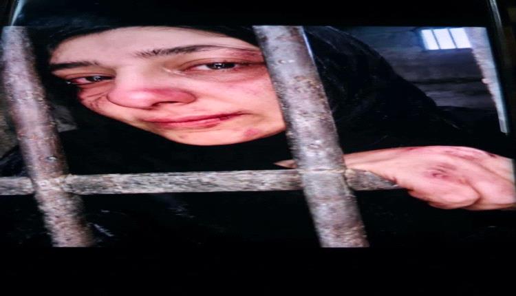 ناشطة يمنية تكشف تفاصيل مروعة عن اعتقالات النساء في مناطق الحوثي