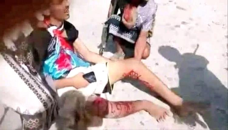 سقوط جرحى من المتظاهرين بنيران قوات الطوارئ اليمنية في سيئون