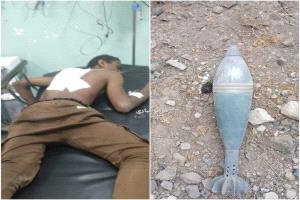 المليشـ,ـيات الحـ,ـوثية تستهدف بقـ,ـذائف الهـ,ـاون الأعيان المدنية شمال الضالع وسقوط ضحايا واضرارًا بالممتلكات