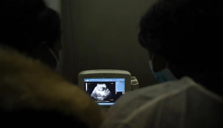 اكتشاف جنين في معدة طفلة مصرية.. نزيف يقود إلى حالة طبية نادرة