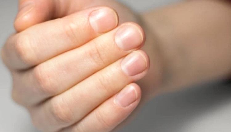 علامة بسيطة في أظافرك تحذر من أمراض صامتة